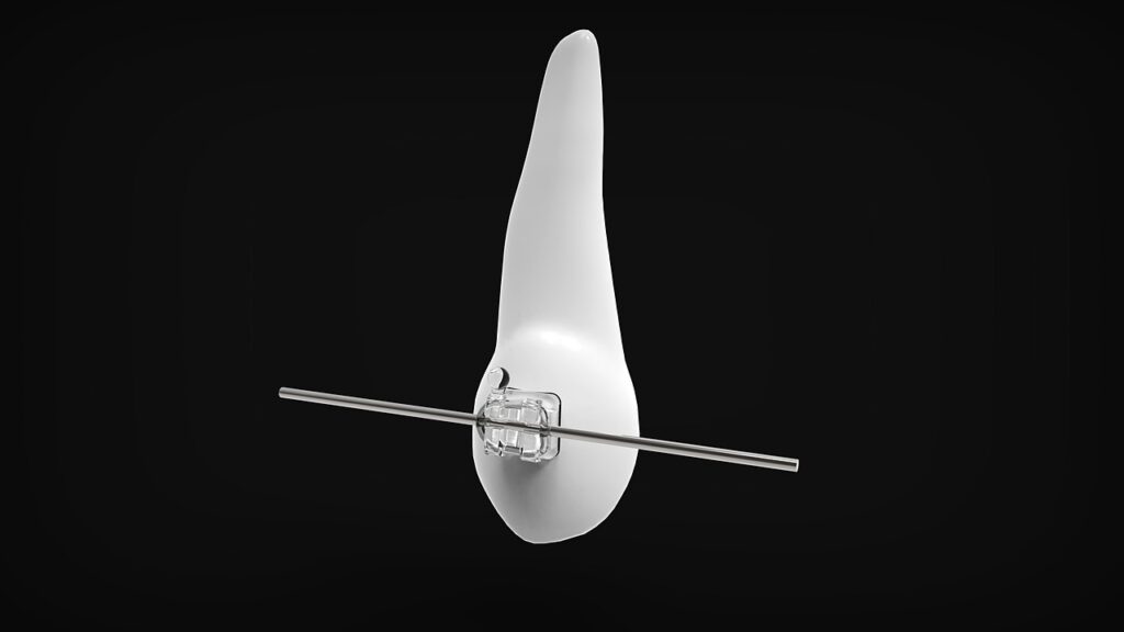 東京で小顔矯正のLINE予約はどこが便利？