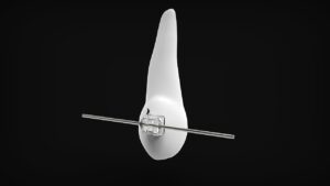 東京で小顔矯正のLINE予約はどこが便利？